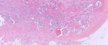 exposition anapath mars bleu