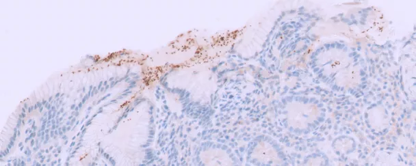 exposition anapath mars bleu