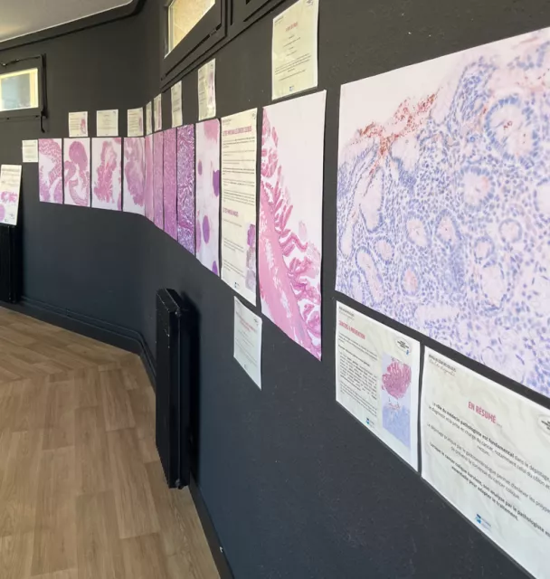 exposition mars bleu